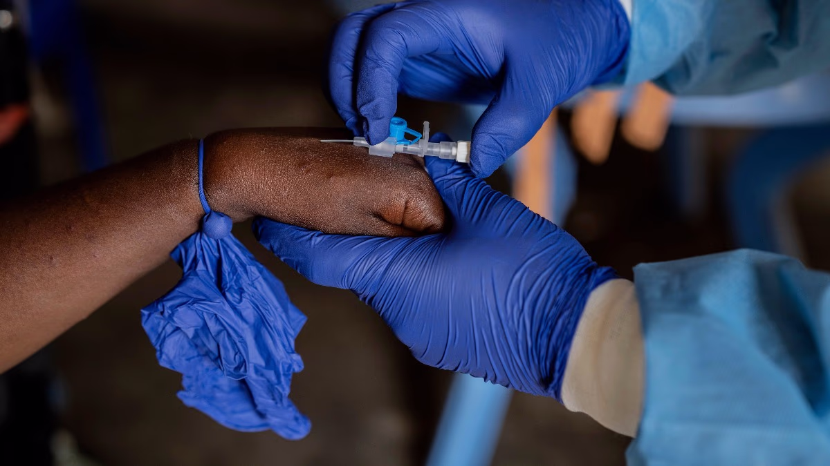 Suspected Mpox case in Kerala (AP Photo/Moses Sawasawa)