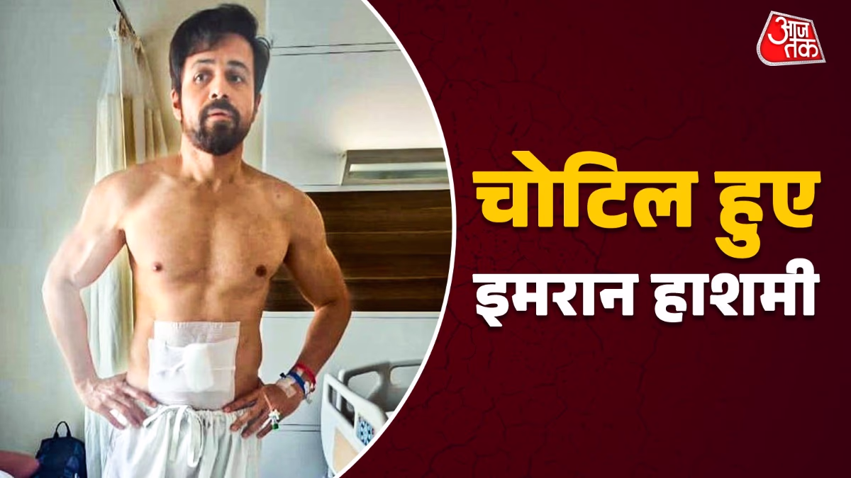 Emraan Hashmi's on-set injury during 'Awarapan 2'