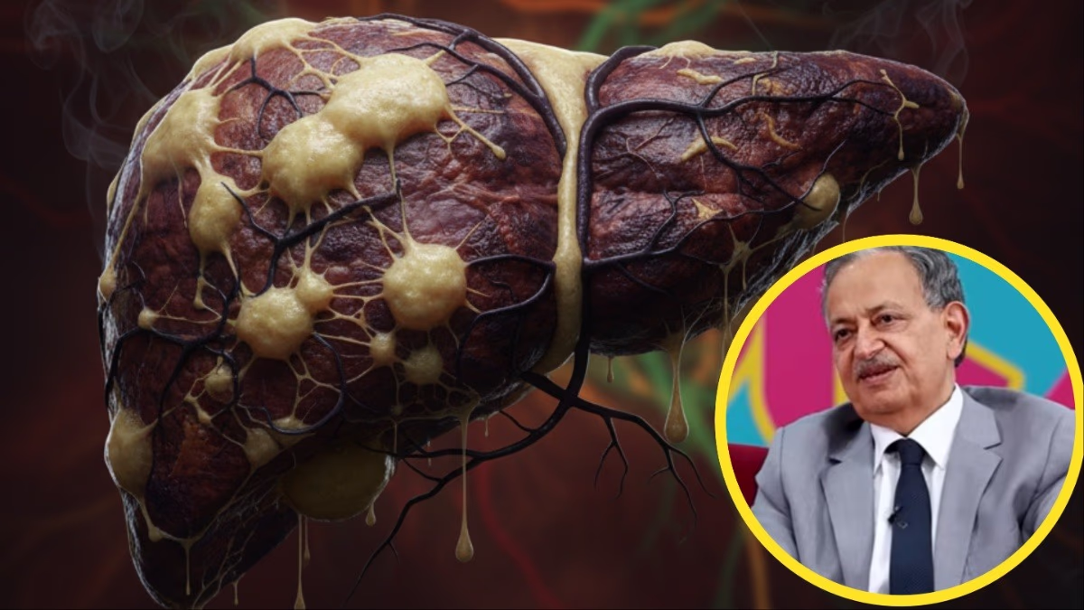 Doctor Shivkumar Sarin shares foods to reduce fatty liver risk.